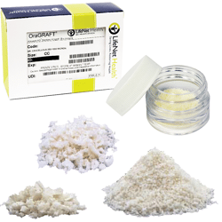 Demineralized Cortical Bone (DFDBA)